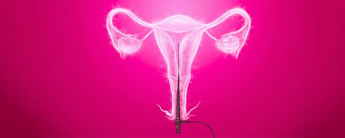 Laparoscopy and Hysteroscopy